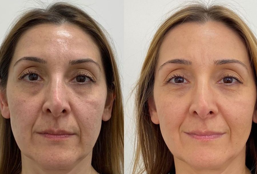 Before / After